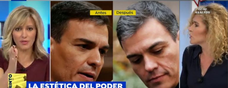 Del retoque facial de Pedro Sánchez al ingerto de pelo de Santi Abascal