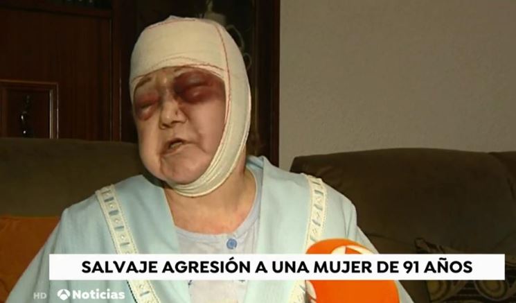 Detienen al hombre que propinó una brutal paliza a una anciana de 90 años