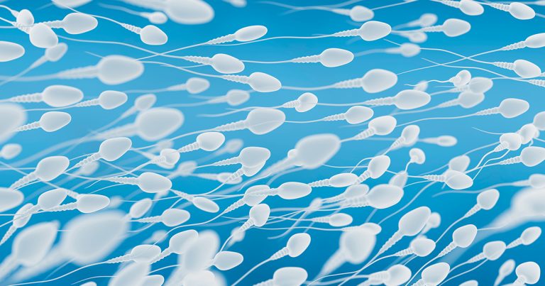 Analizar el semen ayuda a prever la agresividad del cáncer de próstata
