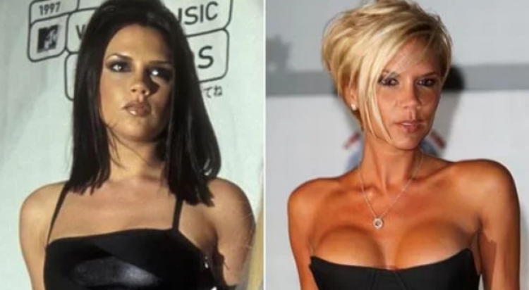 Los 10 peores pechos operados de las famosas