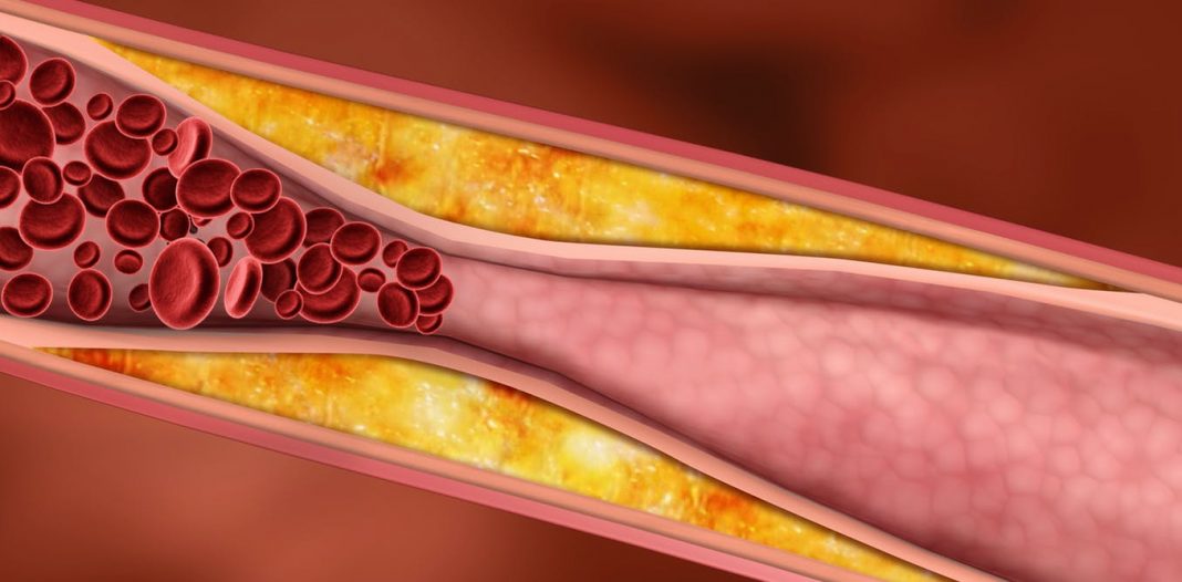 El motivo por el que tener el colesterol bueno bajo te pone en peligro