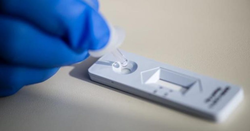 ¿Qué Es Un Test De Antígenos?