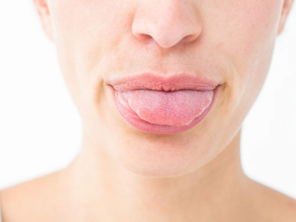 Esto Es Lo Que Dice Tu Lengua De Tu Salud