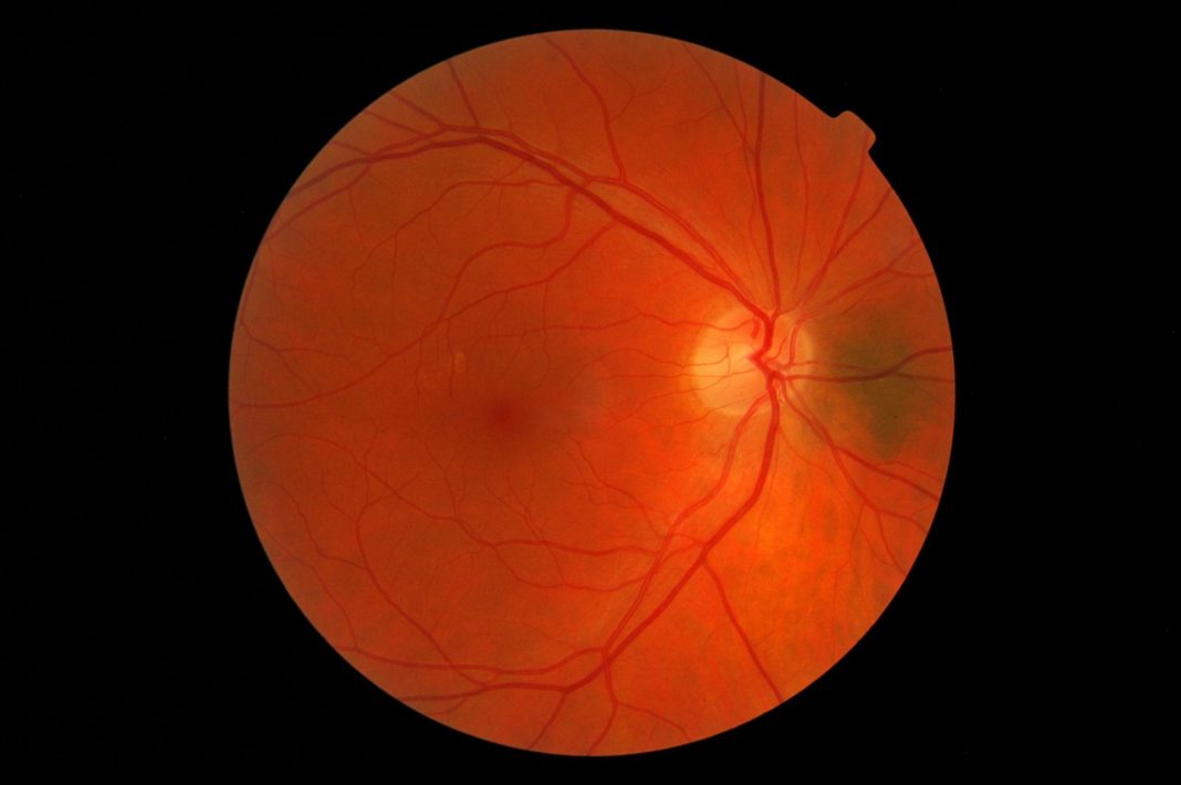 retina