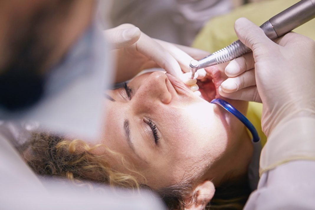 Mejor que un dentista: así se puede eliminar el sarro de los dientes en casa