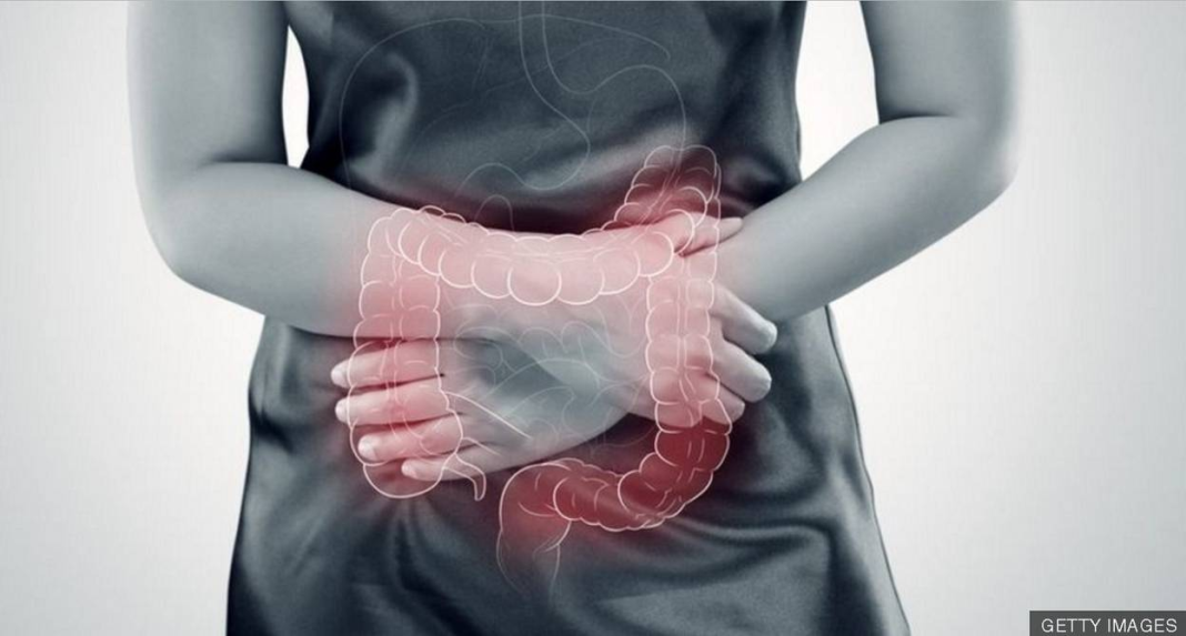 Estos son los síntomas del síndrome del colon irritable