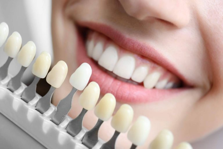 Los implantes y el tratamiento de ortodoncia aplicados por DrMouth
