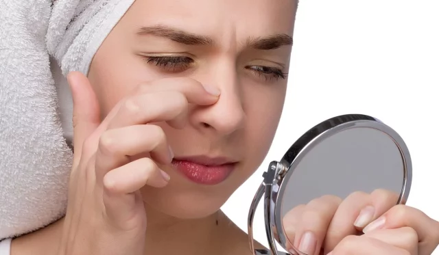 Los 3 Remedios Caseros Que Te Ayudarán A Combatir Los Granos De La Cara