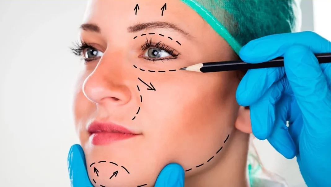 Otoplastia: armonizando el rostro