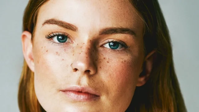 Atento Al ‘Freckling’, La Nueva Moda De Tatuarse Como Un Filtro De Instagram