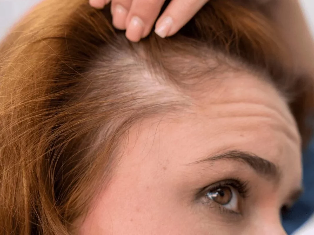 Cómo tomar las cápsulas de cabello y uñas de Mercadona